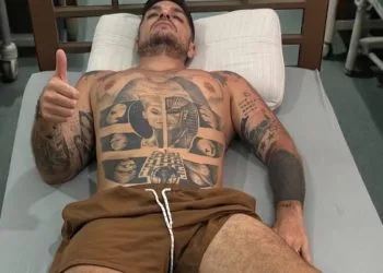 Luigi Favoloso morso da un serpente